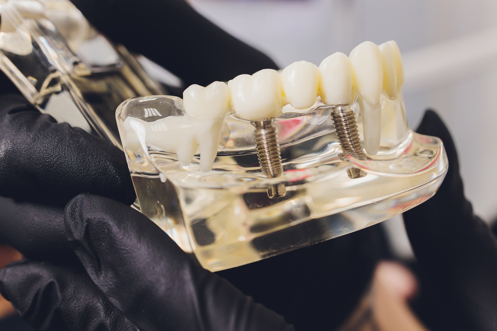 Orthodontist holds jaw in his hands for training. Package with capillaries, roots, pins.