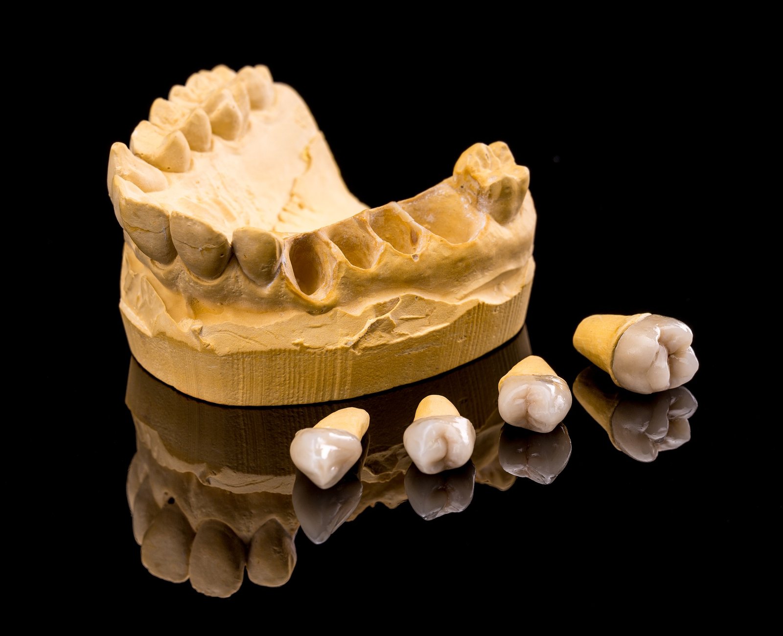 Ceramic dental Implant