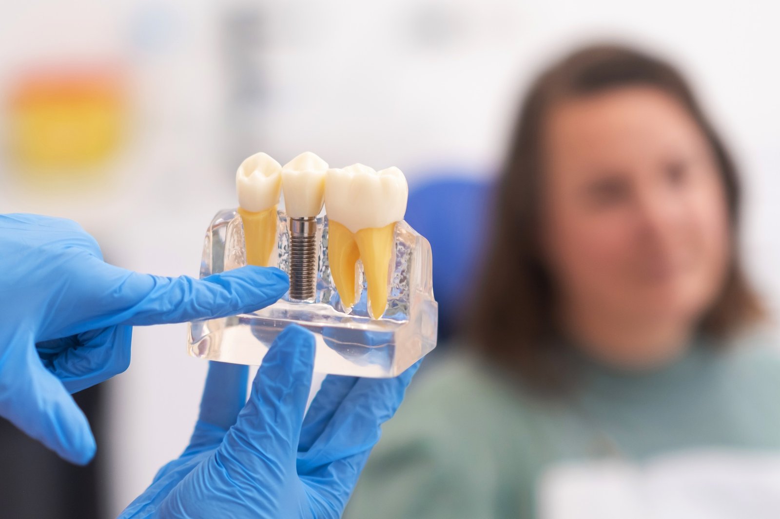 dental implant success rate