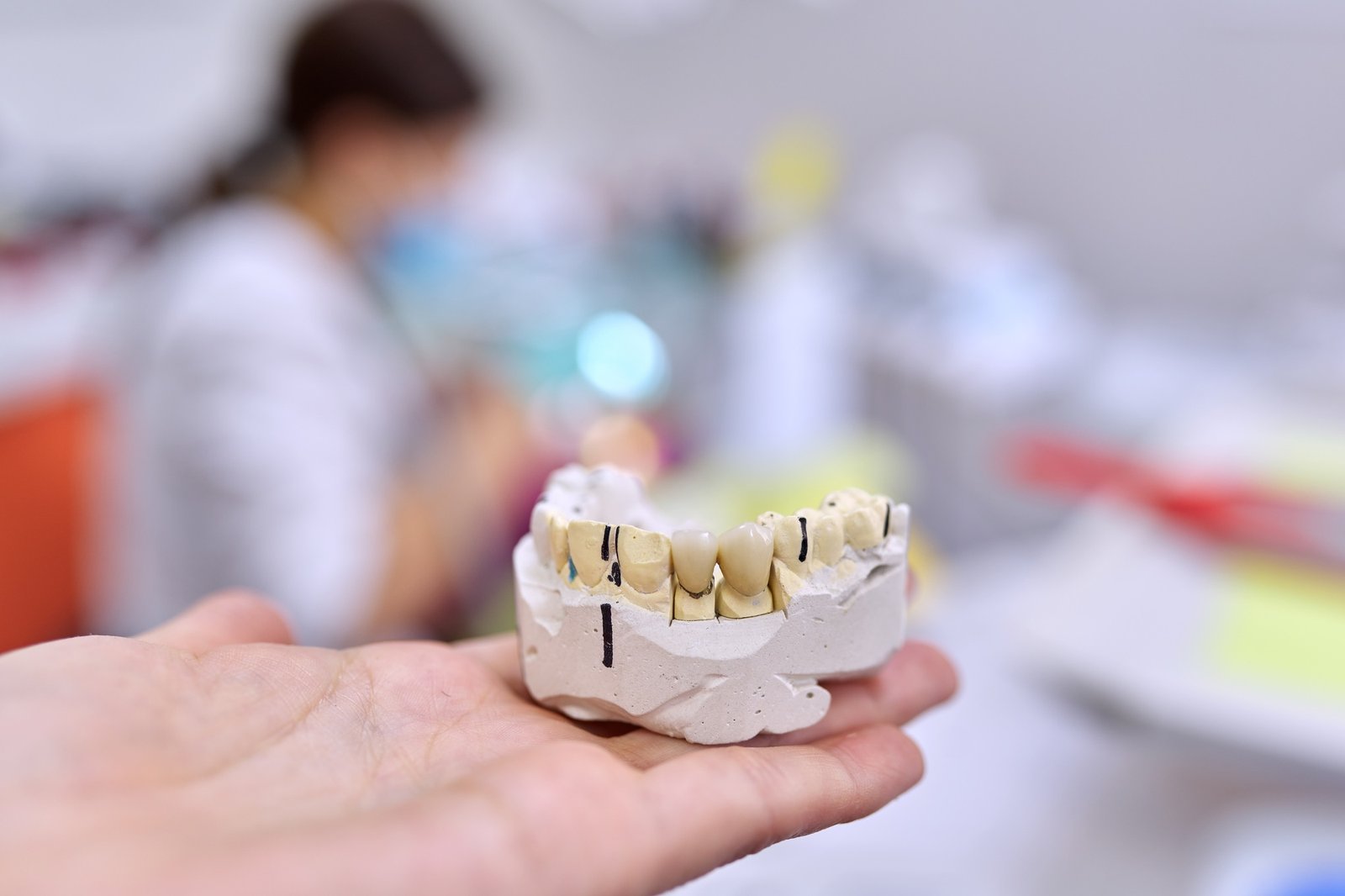gypsum-model-of-teeth-of-jaw-with-ceramic-crowns