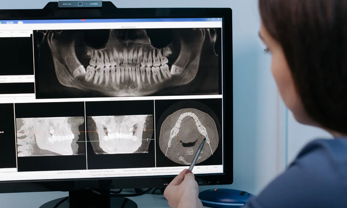 7 Signs You May Need a Dental Implant Instead of a Filling