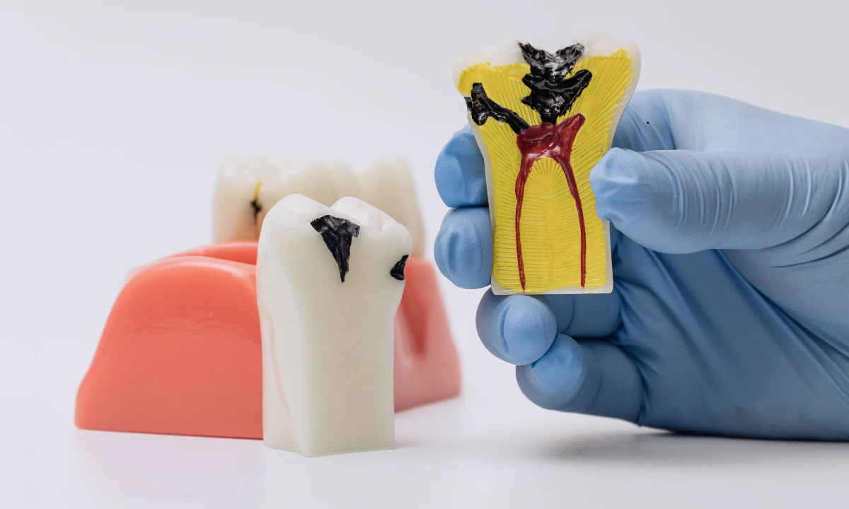 dental implant infection