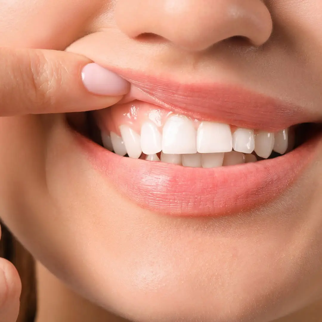 Gum Disease Statistics